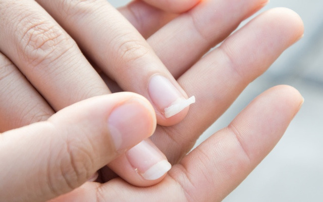 During winter, the nails tend to get broken, chipped, or peeled more easily.