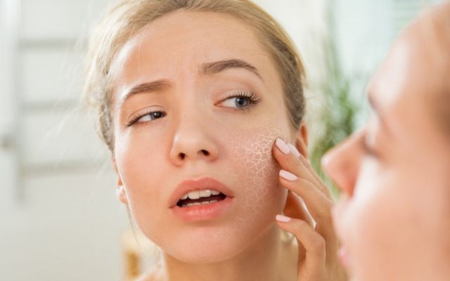  Dry skin is common in summer