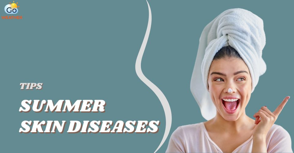 Skin Diseases in Summer Season: Acne Breakouts, Sunburn & 3 More