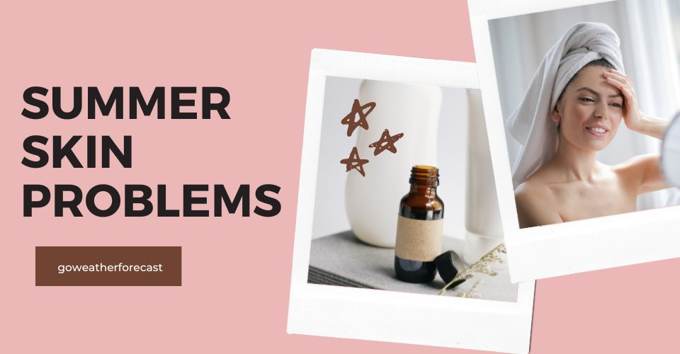Avoid These Summer Skin Problems to Look Perfect in Hot Weather
